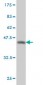 QPRT Antibody (monoclonal) (M01)